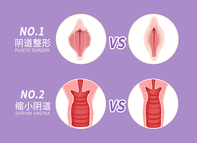 陰道緊緻小秘密？3D生物束帶“束”住幸福