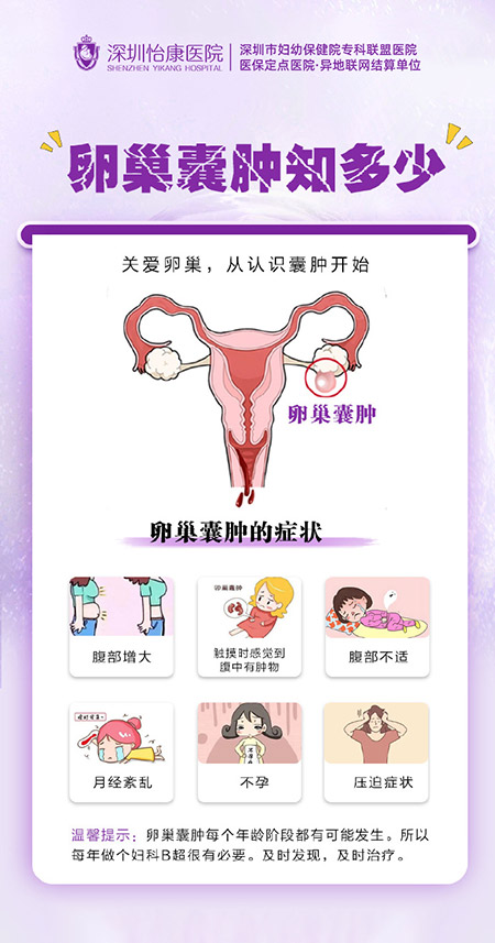「卵巢囊腫有咩症狀？月經亂＋腹脹可能係警號｜深圳怡康專科醫生解構」